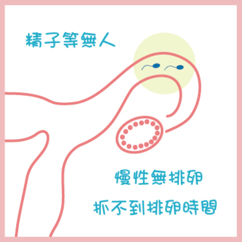 多囊性卵巢症候群PCOS：Polycystic Ovaries Syndrome  |服務項目|閨密悄悄話