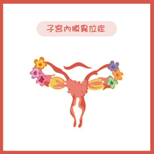 子宮內膜異位症 Endometriosis  |服務項目|閨密悄悄話