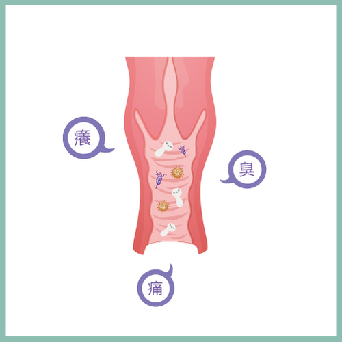 陰道炎產品圖